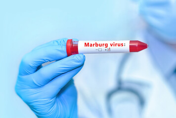 U.S. Issues Travel Alert Because Of Marburg Virus Outbreak In Rwanda