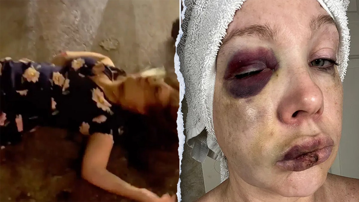 Cincinnati victim Holly (L) as she was beaten to the ground and (R) after the incident.