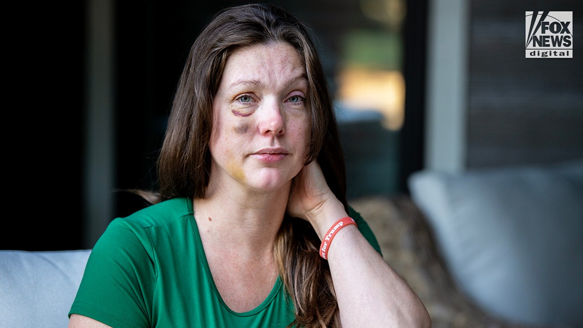 Cincinnati brawl victim Holly poses for a photo