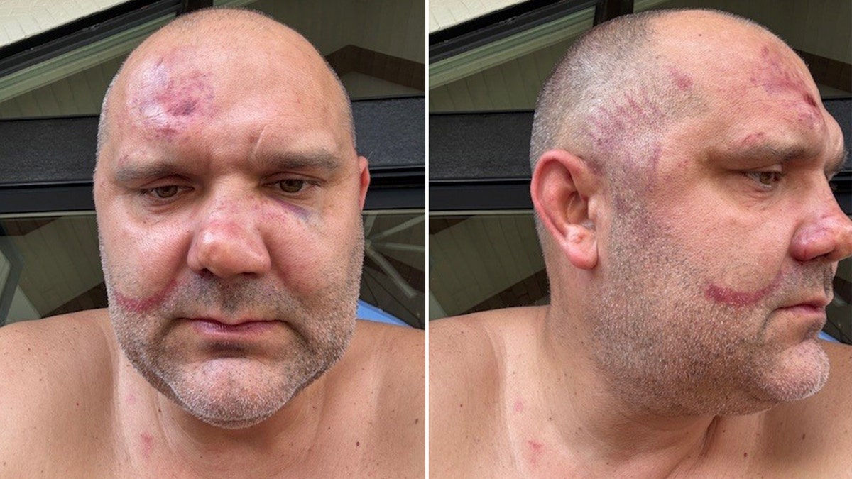 Cincinnati assault victim Alex Tchervinski