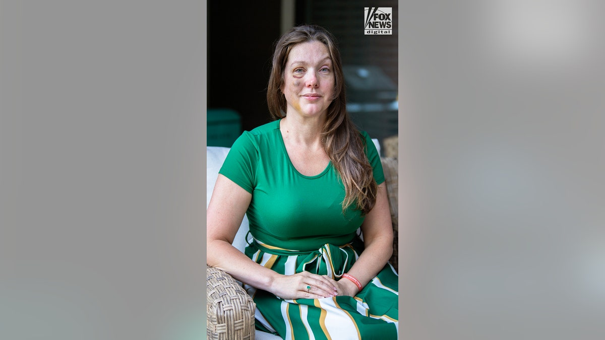 Cincinnati brawl victim Holly poses for a photo