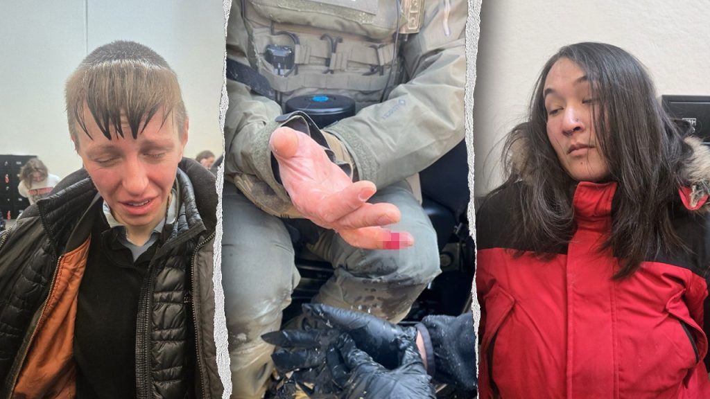 Anti-ICE agitator allegedly bites off federal officer’s finger during Minneapolis attack Anti-ICE agitator allegedly bites off federal officer’s finger during Minneapolis attack